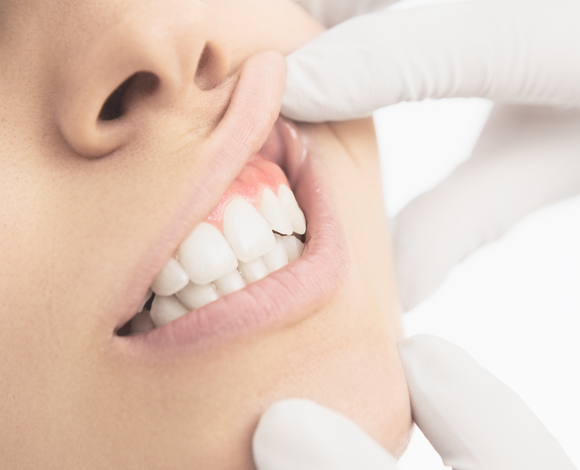 Important Tips for Recovering From Gum Grafting Surgery