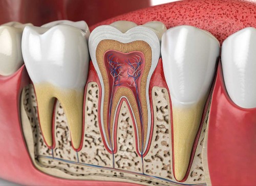Root Canals